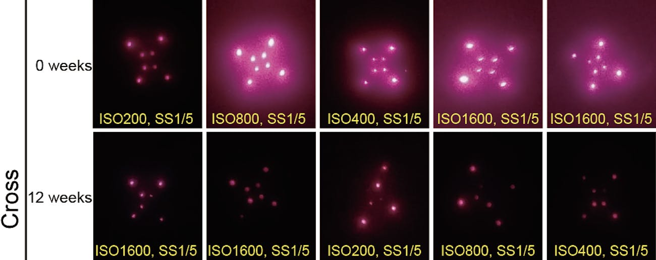 medical records, micro needle 