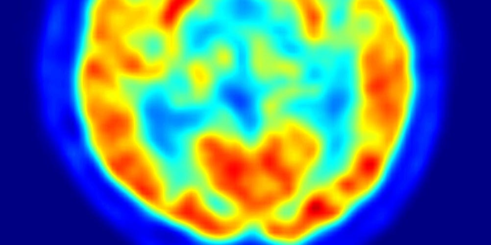 brain on drugs scan fmri