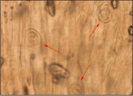 This microscope image shows the Trichonella spiralis cysts in the questionable boar meat, magnified 100x.