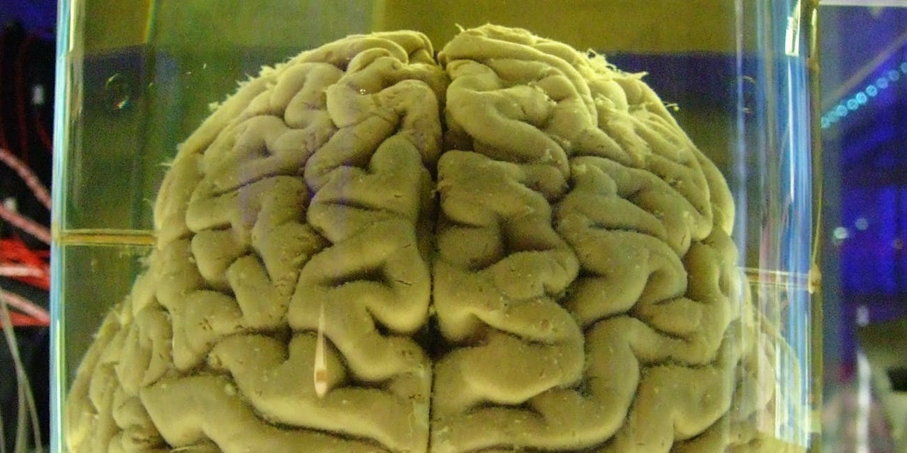 The almighty brain.