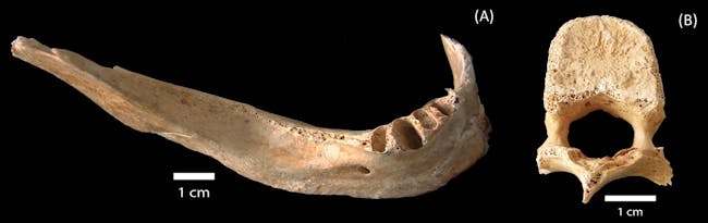 The victim’s mandible collected at Hirose and Nakahiro-machi.The victim’s mandible collected at Hirose and Nakahiro-machi.