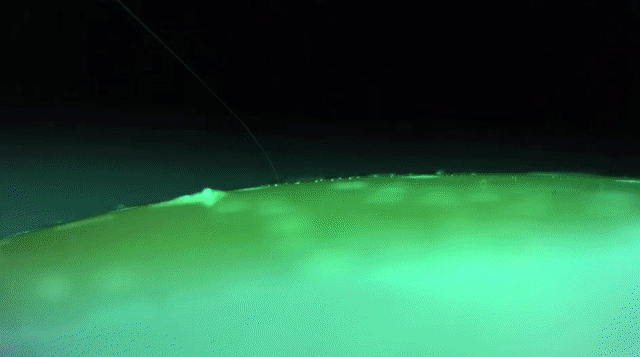 A Neuralink robot performs electrode insertion in this video from a Neuralink presentation on July 16, 2019.