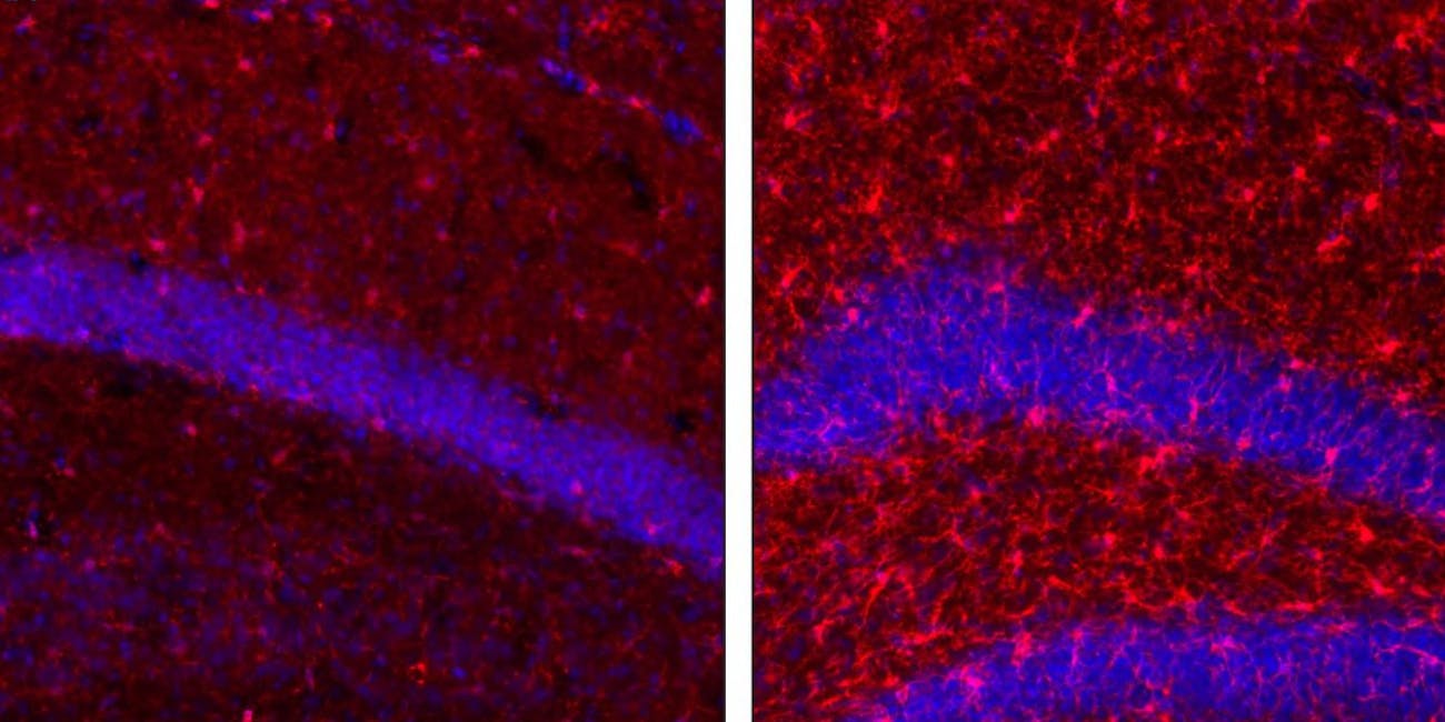 influenza brain cells