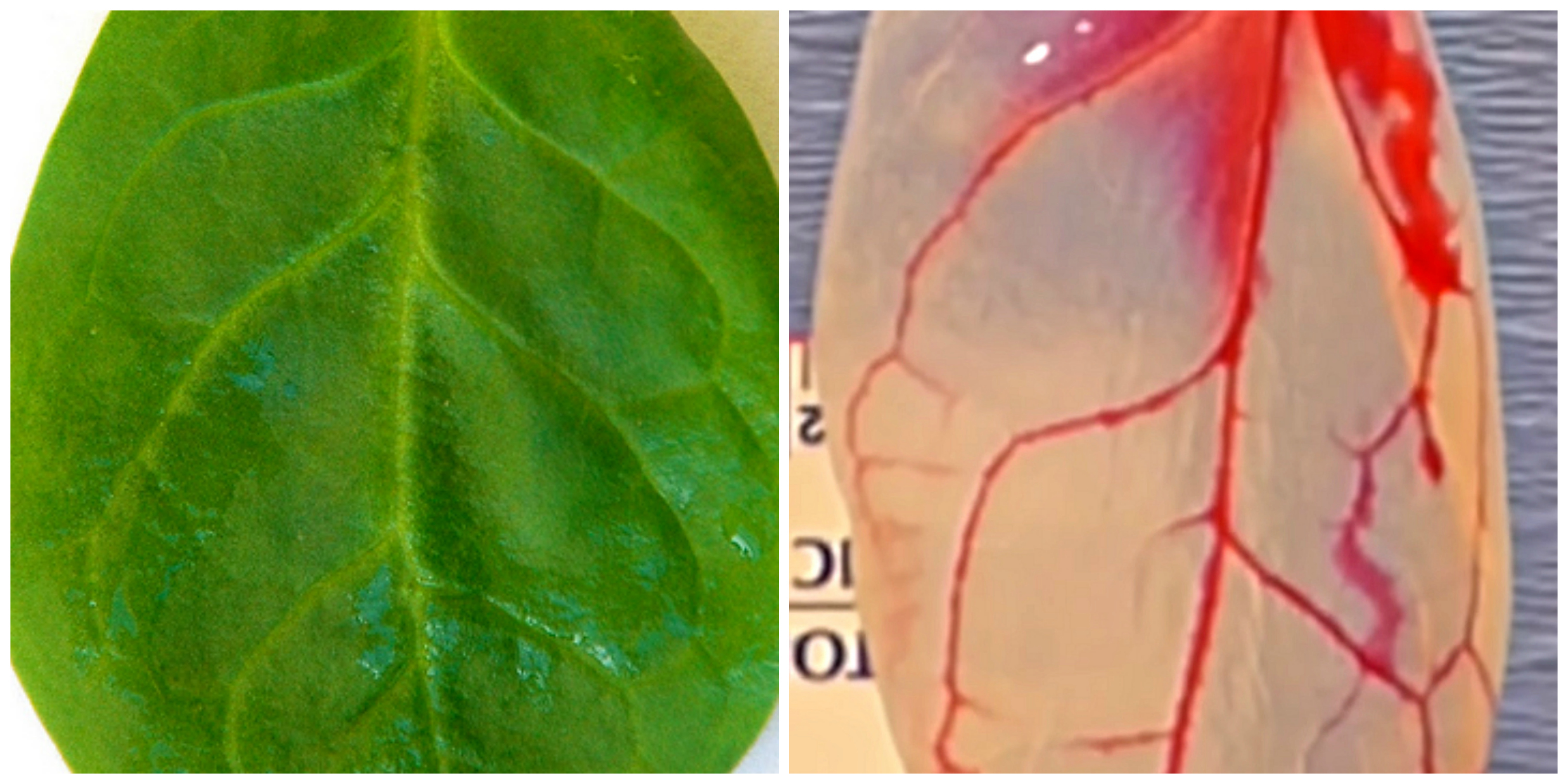 Why Scientists Used Spinach to Grow Human Heart Tissue Inverse