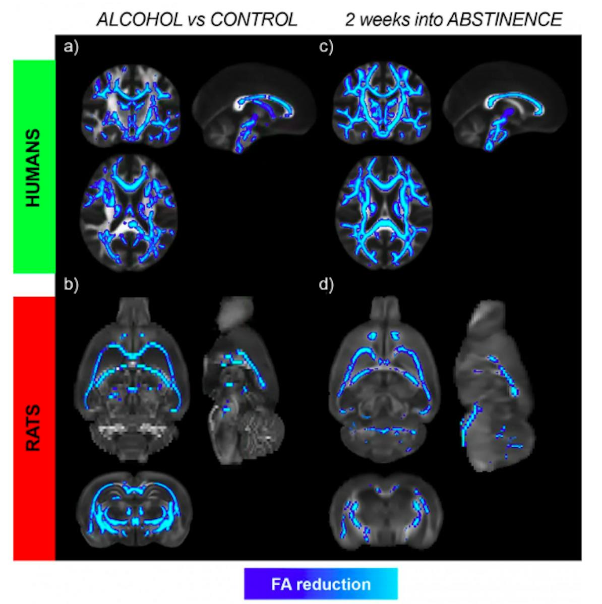 brain, alcohol
