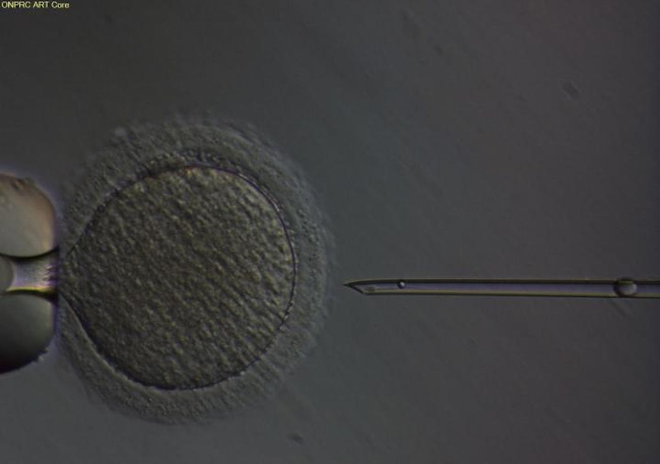 sperm, egg