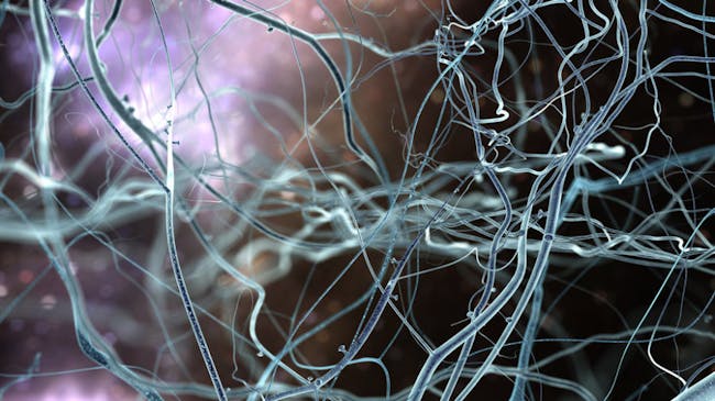 Artist rendition of what neurons look like.