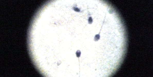 sperm