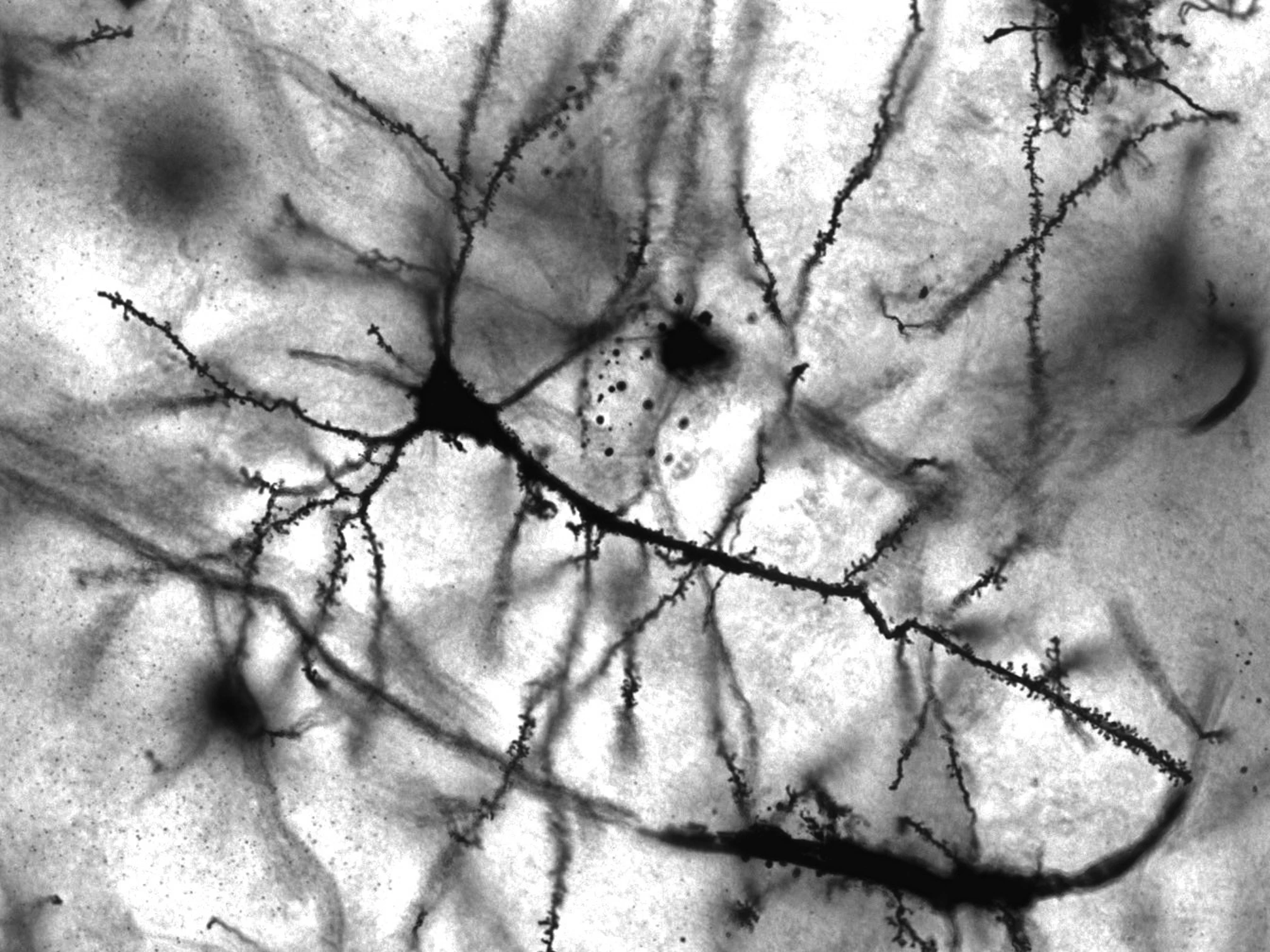 Kernel's Neural Implants Could Boost Failing Human Brains | Inverse