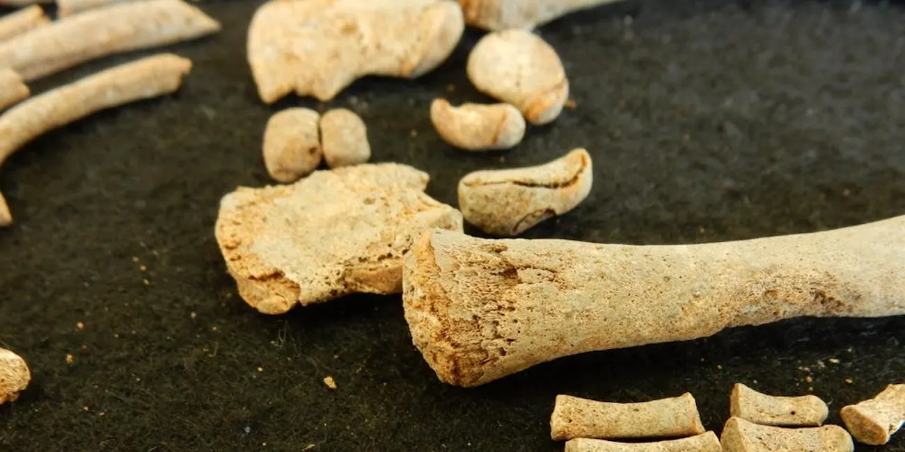 Oldest-Ever Syphilis DNA Sequenced From Convent Cemetery Skeletons ...