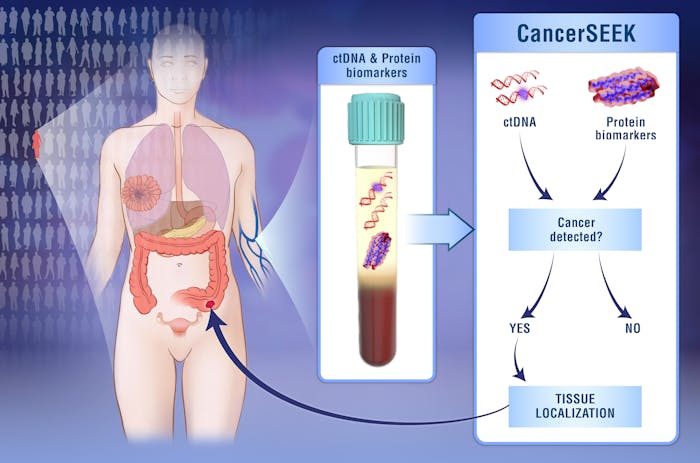 Doctors have developed a noninvasive blood test for eight types of cancer.