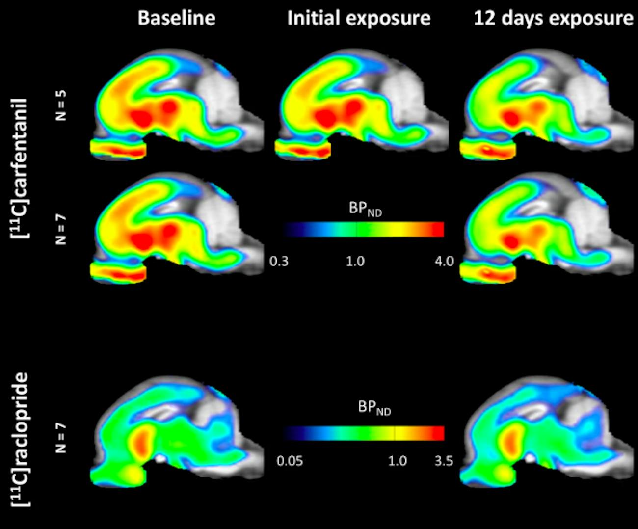 brain scans, sugar 