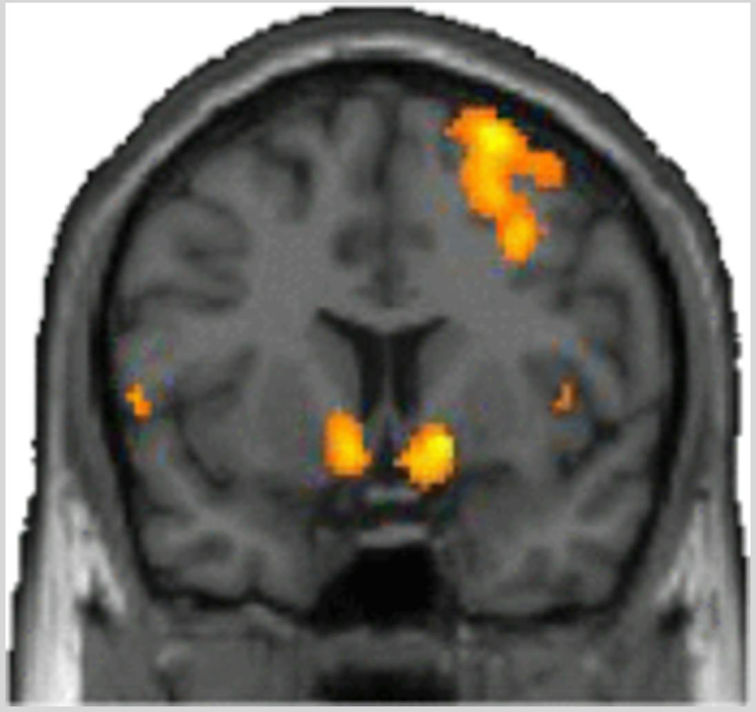 Behavior - Neuroscience Reveals How the Brain Changes as It Watches ...
