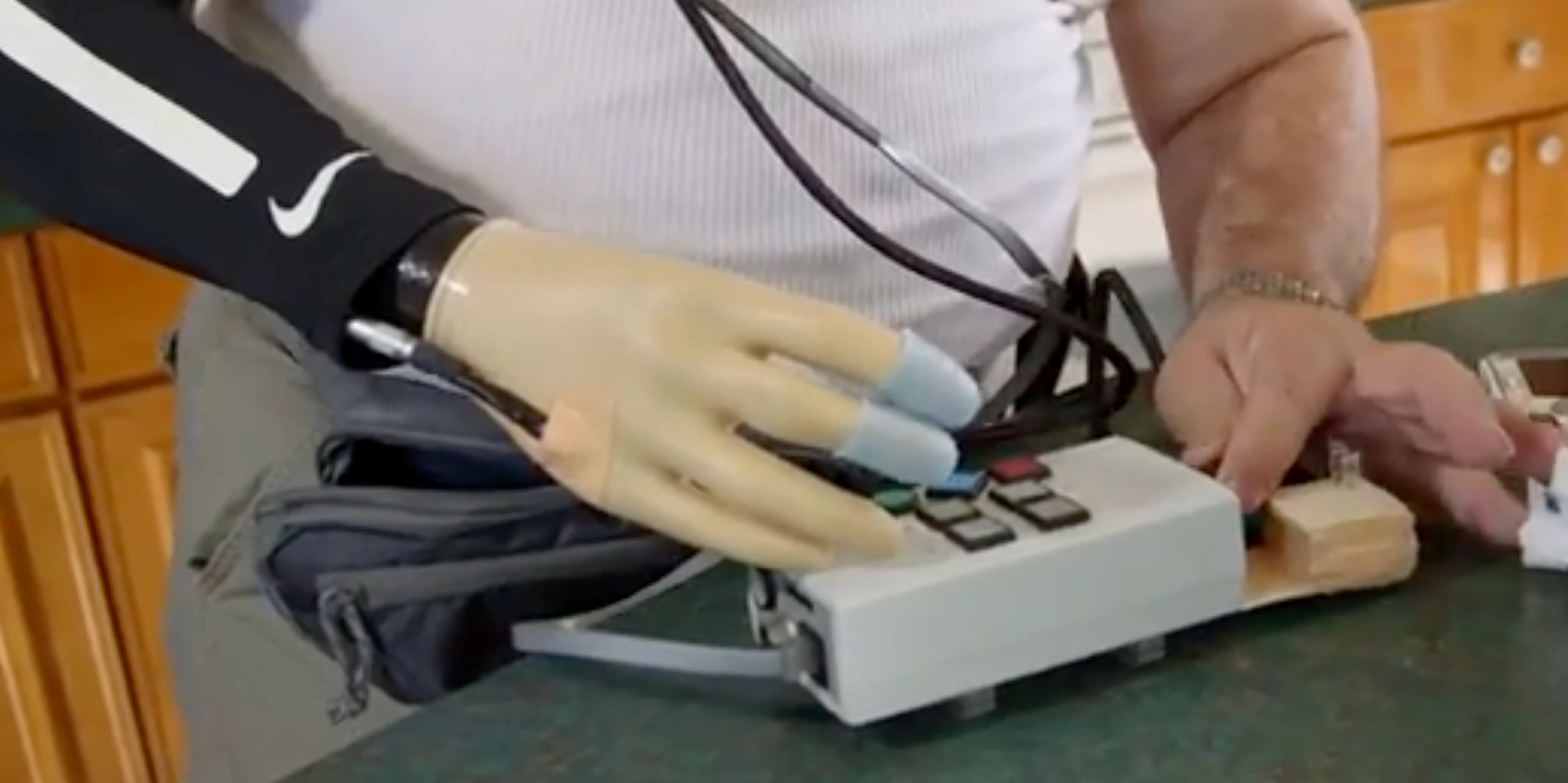Neuroscientists Restore The Sense Of Touch To Amputees With Prosthetic neuroscientists-restore-the-sense-of-touch-to-amputees-with-prosthetic