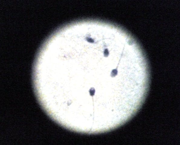 sperm