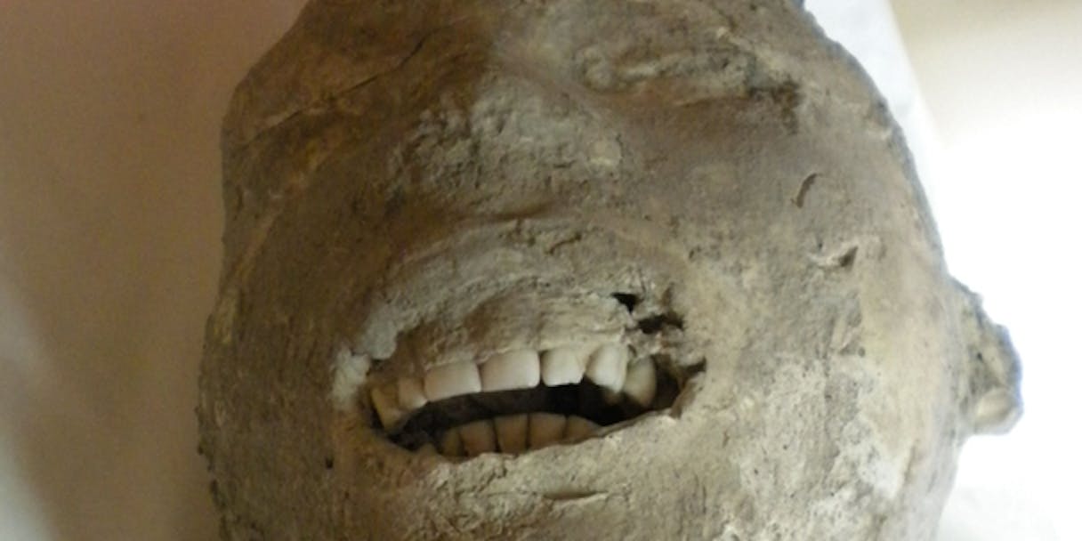 of catalogue victims Pompeii Teeth Victims of Had Healthy Diet Perfect Because of catalogue victims Pompeii Teeth Victims of Had Healthy Diet Perfect Because