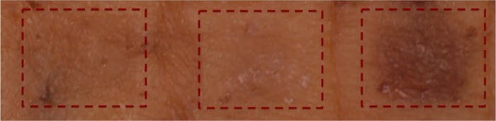 human skin