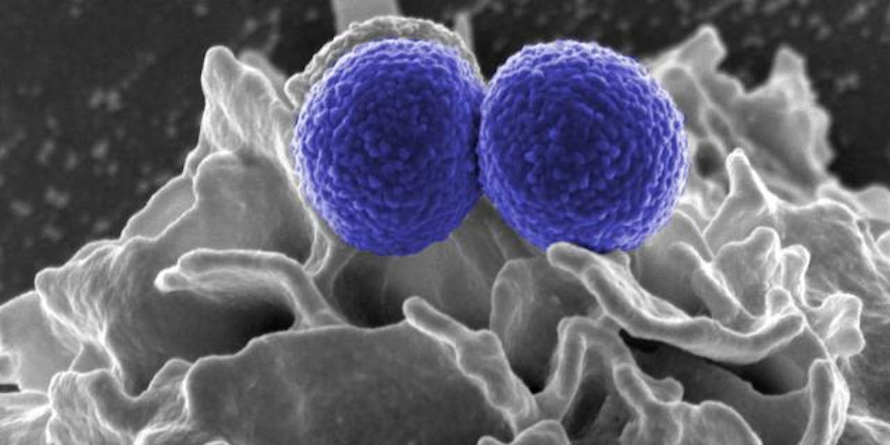 Methicillin-Resistant staphylococcus (MRSA) Bacteria
