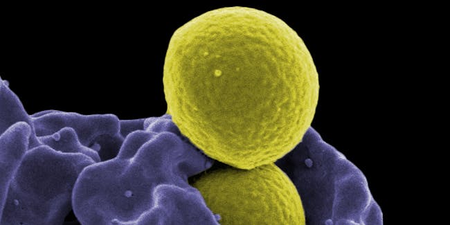 Methicillin-Resistant Staphylococcus aureus (MRSA)