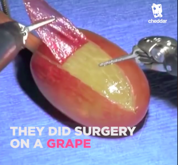 they did surgery on a grape they did surgery on a grape