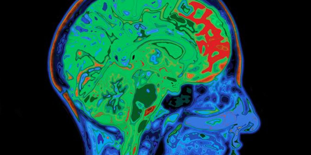 brain imaging
