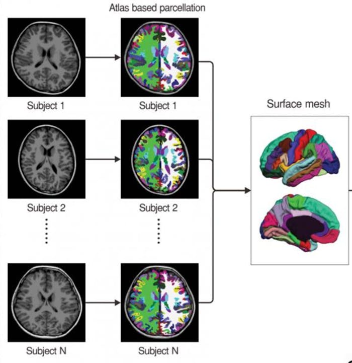 Study on the Brains of ADHD Patients Has Implications for the Adderall