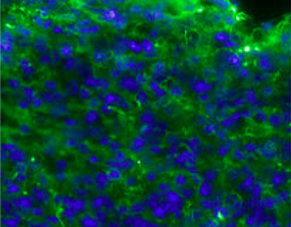 organoid neurons