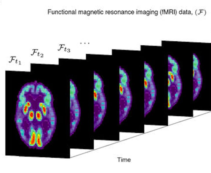 fmri