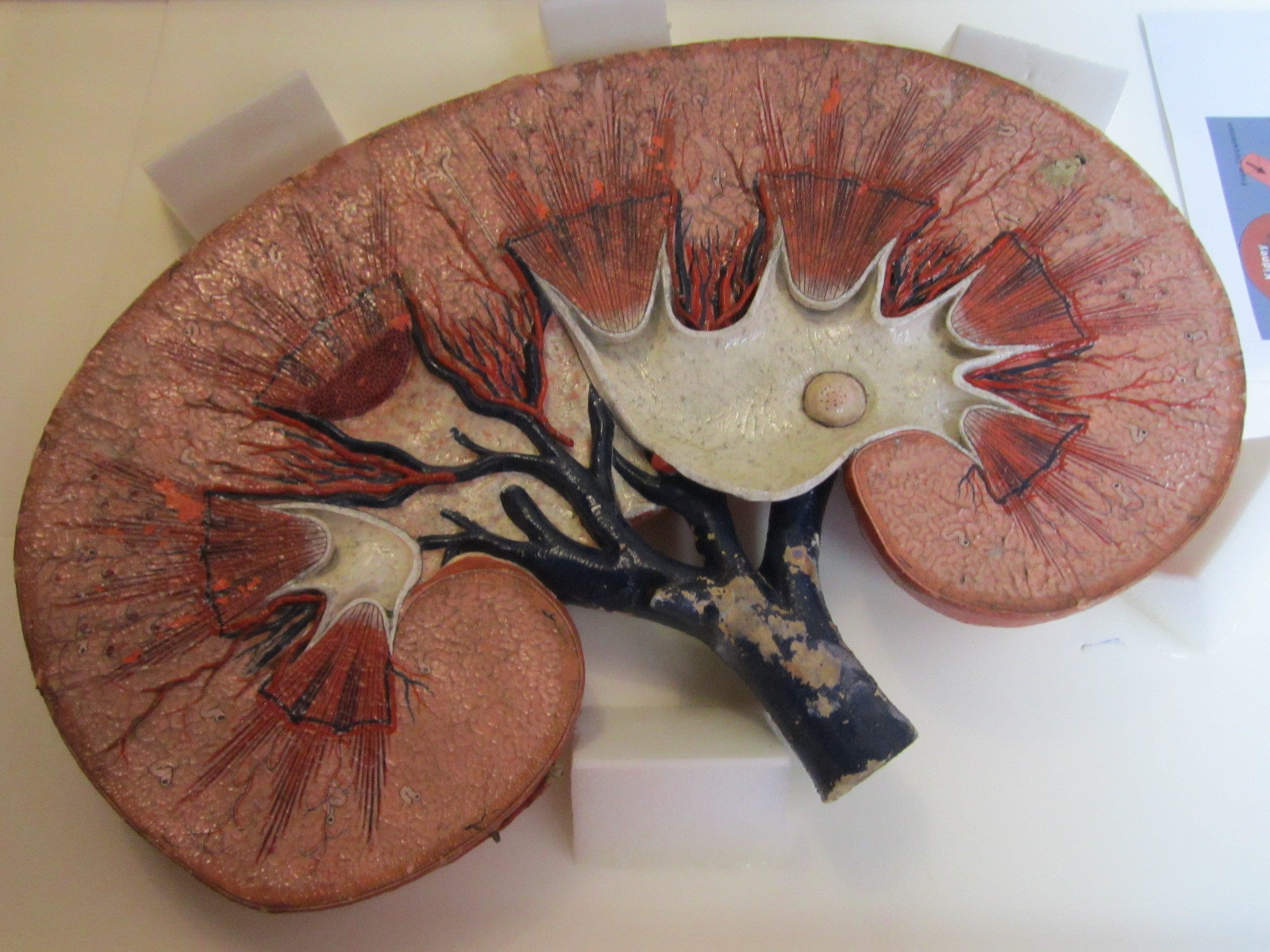 The Kidney Project Is Creating a Bioartificial Kidney Inverse