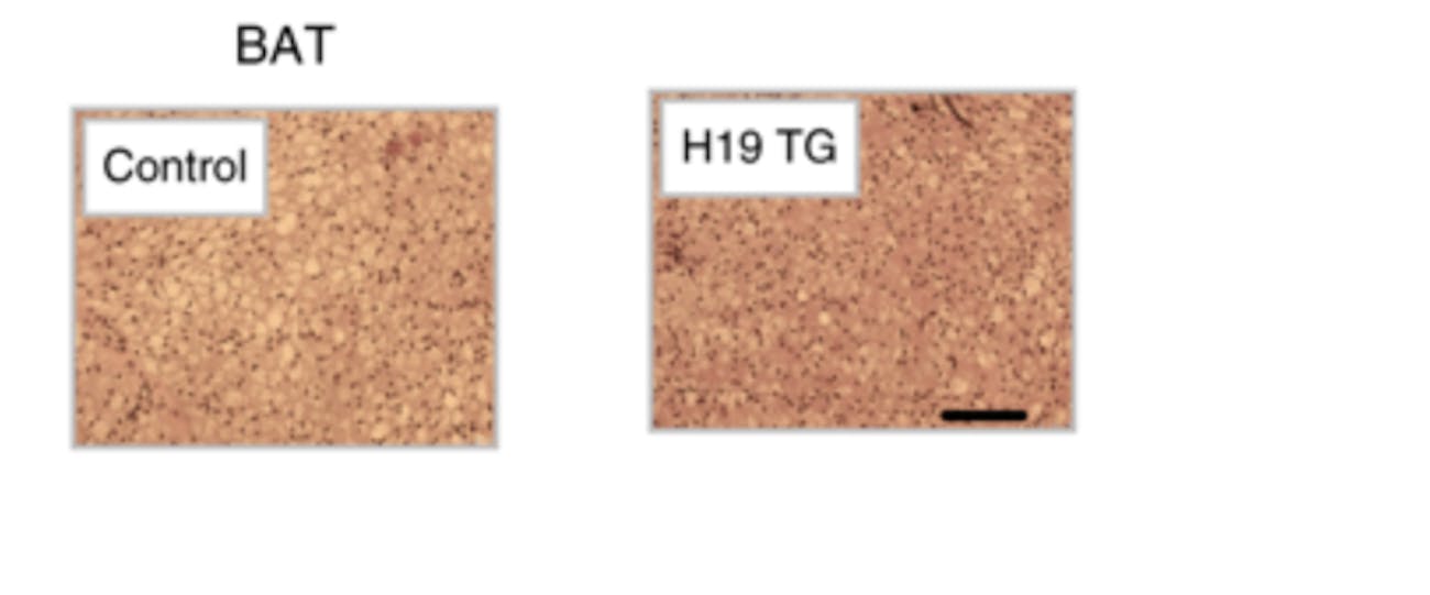 brown fat versus white fat