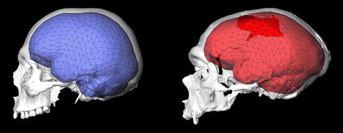 Neanderthal brain shape