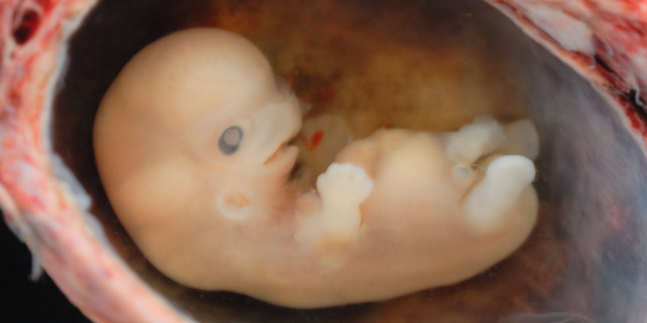 Image result for embryo human