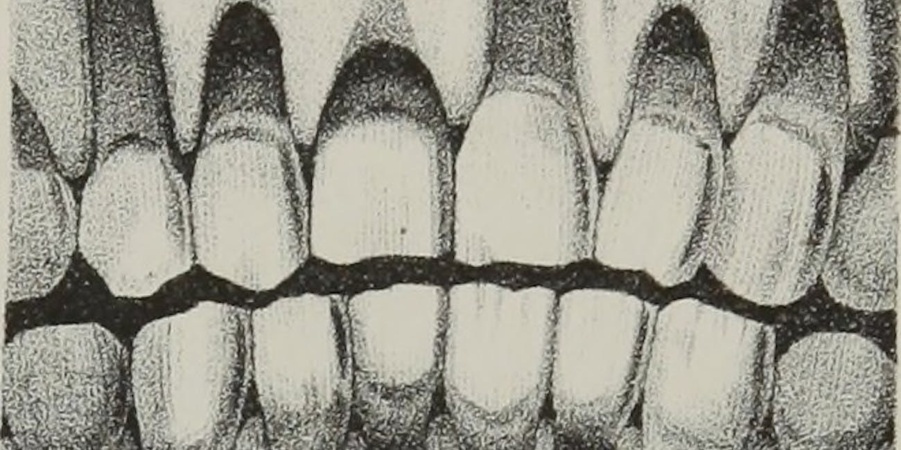 Image from page 225 of "The anatomy, physiology and pathology of the human teeth : with the most approved methods of treatment : including operations, and the method of making and setting artificial teeth, with thirty plates" (1844)