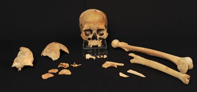 skeletal remains ancient human Scandinavia
