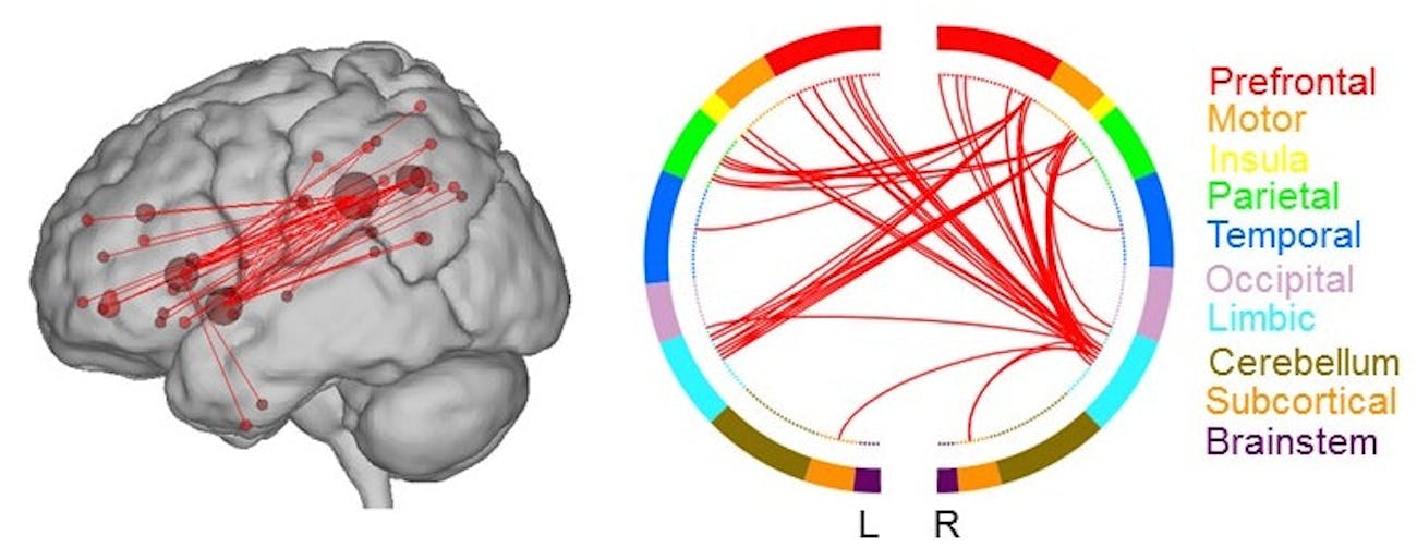 creative brain