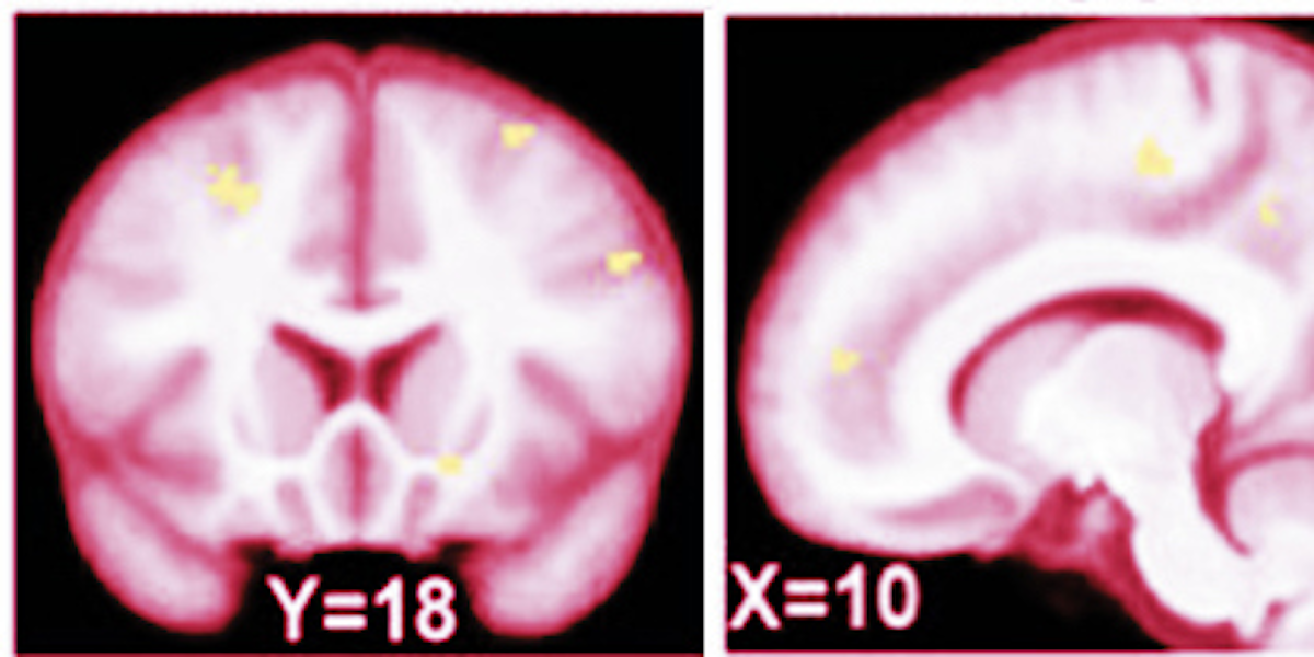 Brain Scans Reveal How to Make Cheap Wine Taste Expensive Inverse