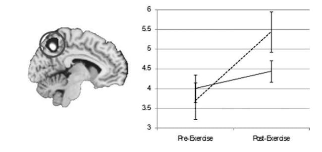 brain scans dehydration