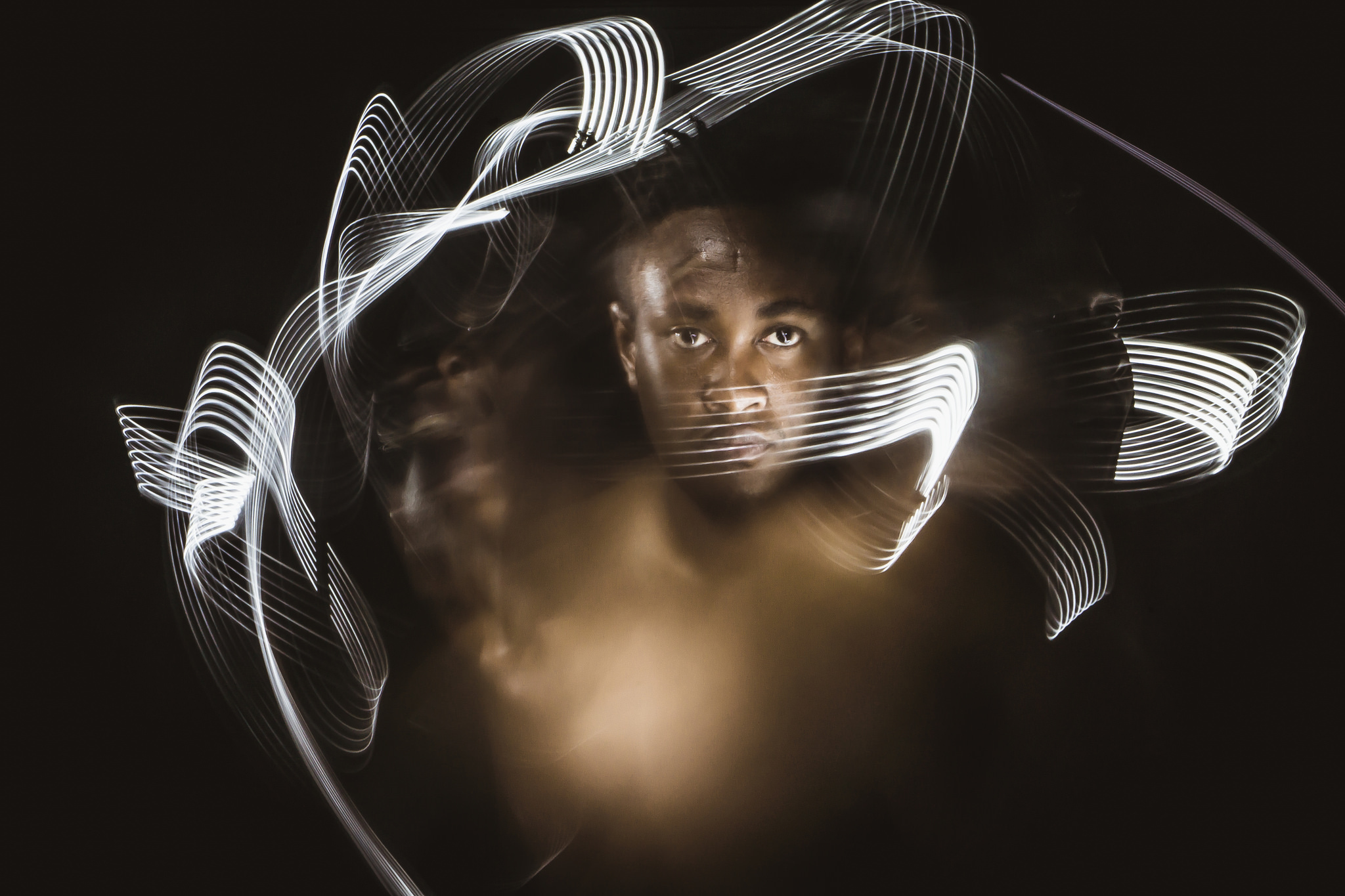 Does Prozac Really Treat Anxiety? Maybe Not