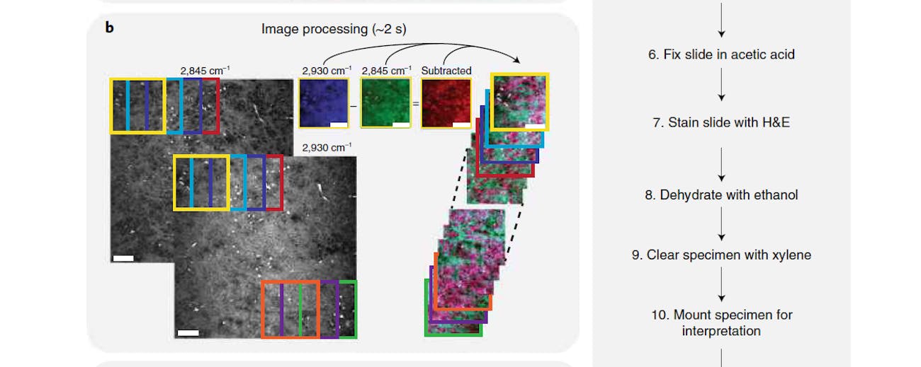 The second section of a chart comparing A.I and human neuropathologists.