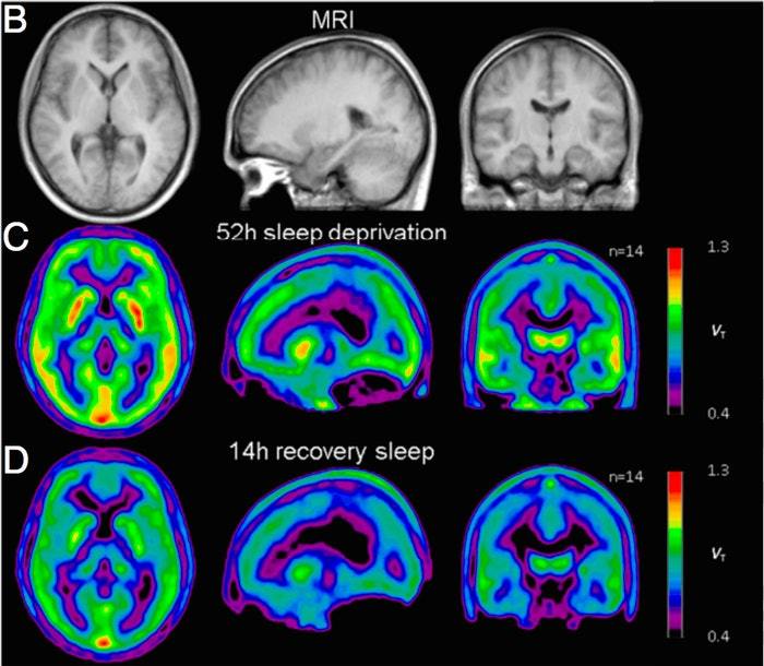 Scientists Say Some People Recover Faster From Sleep Deprivation | Inverse