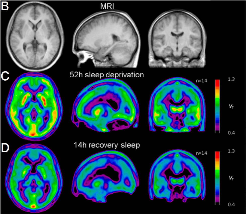 scientists-say-some-people-recover-faster-from-sleep-deprivation-inverse