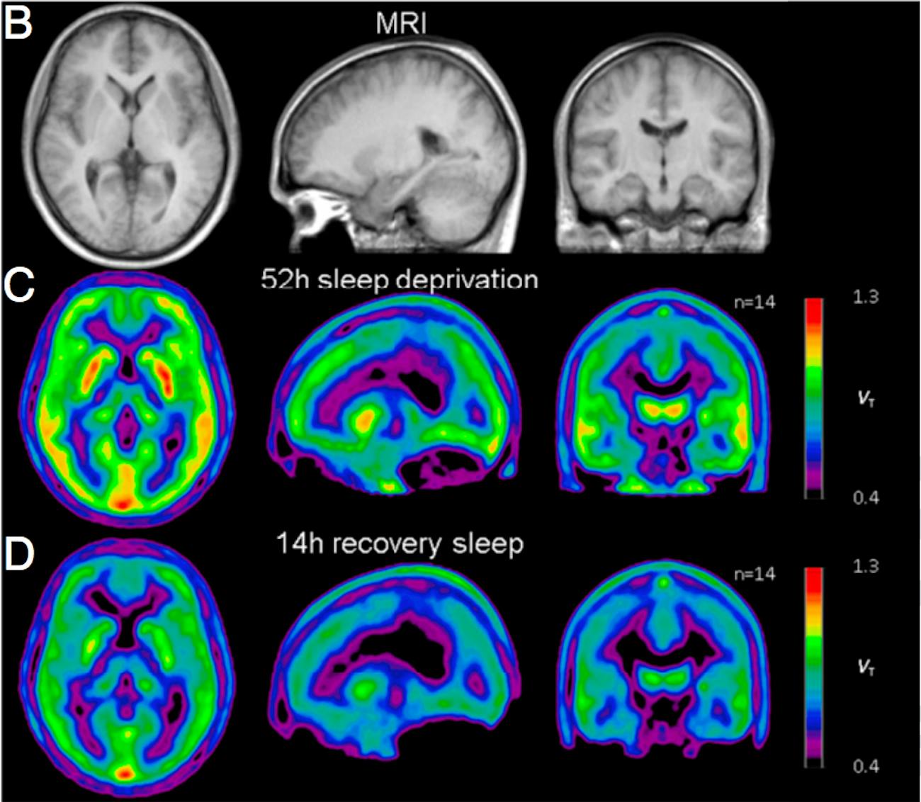 Scientists Say Some People Recover Faster From Sleep Deprivation Inverse