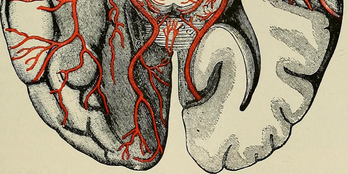 Image from page 494 of "A treatise on the nervous diseases of children : for physicians and students" (1895)