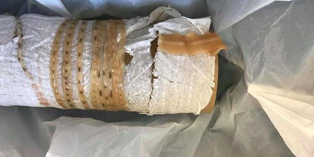 tapeworm