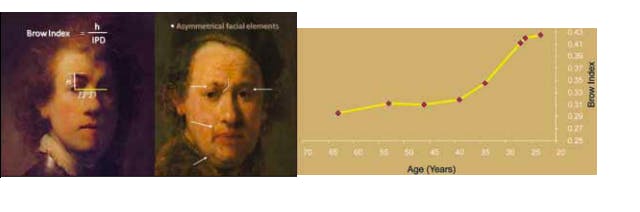 aging brow index