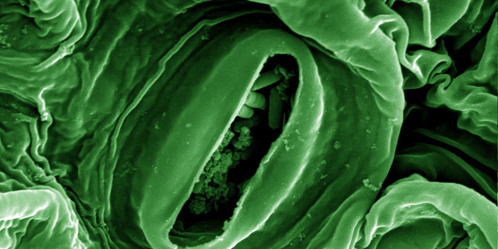 E. Coli Symptoms From Romaine Lettuce: What Does Food ...