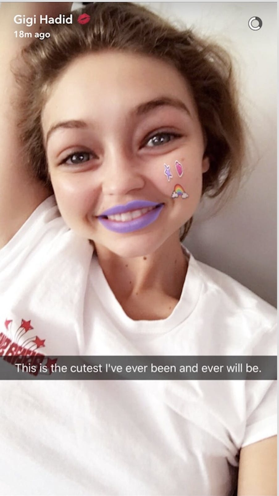 Snapchat Dysmorphia: Plastic Surgeons Are Concerned About ...