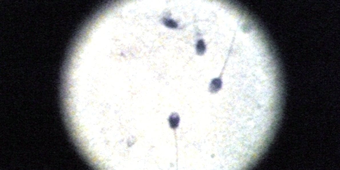 sperm