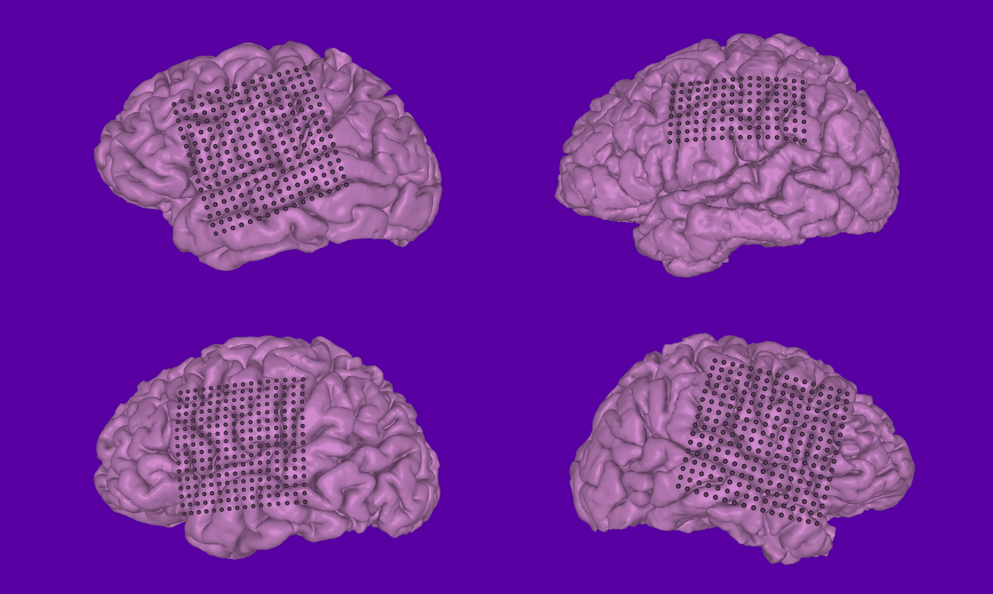 neuroscience-inverse