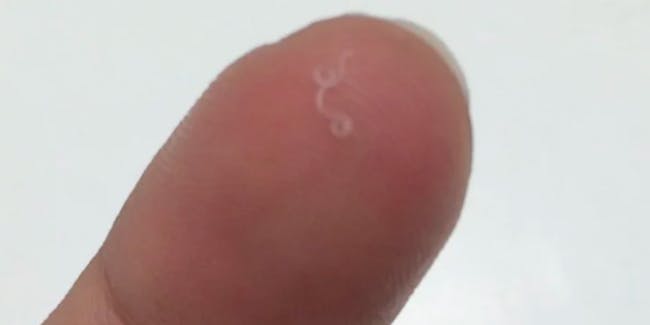 Beckley took this photo of the worm she extracted from her own eye.